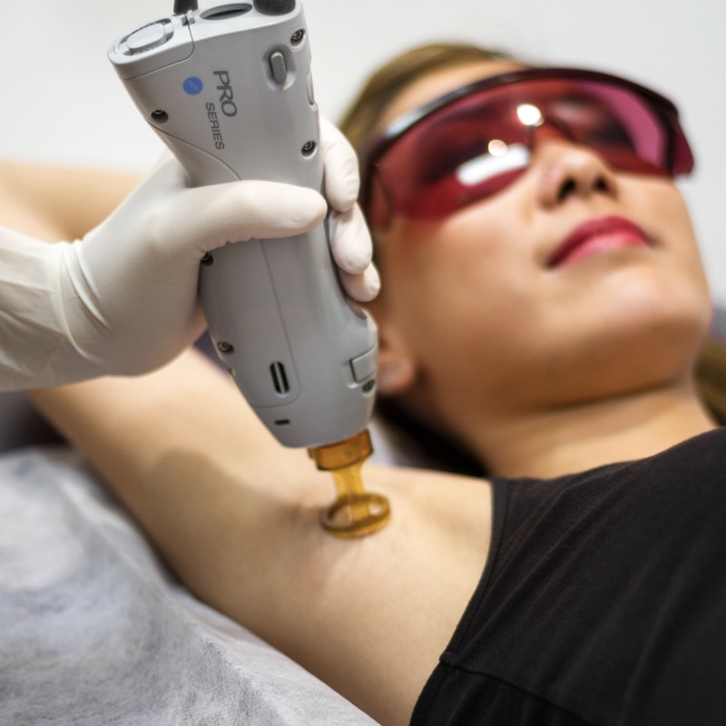 A laser and IPL treatment demonstration